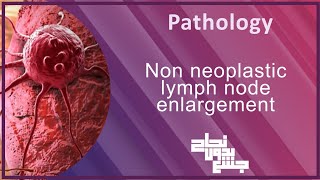 L1  Non neoplastic lymph node enlargement  Pathology [upl. by Kcirevam]