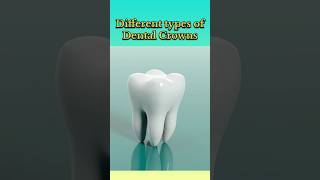 Different Types of Dental Crowns🤩🦷✨ shorts youtubeshorts [upl. by Skrap]