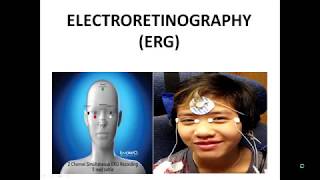 Electroretinography ERG and Electrooculography EOG [upl. by Luci]