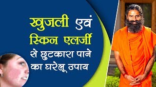 खुजली एवं स्किन एलर्जी से छुटकारा पाने का घरेलू उपाय  Swami Ramdev [upl. by Annas560]