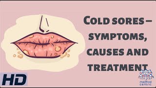 Cold Sores – Symptoms Causes and Treatment [upl. by Shawnee902]