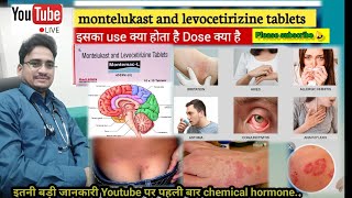 montelukast levocetirizine  सर्दी जुखाम खांसी एलर्जी के लिए रामबाण दवाएं [upl. by Kaliski665]