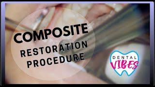 COMPOSITE RESTORATION PROCEDURE  Dental Filling featuring the Solea AllTissue Laser [upl. by Daisey990]