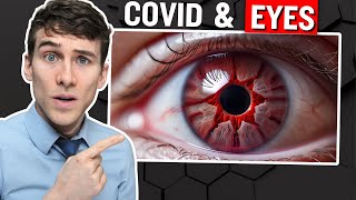 The SURPRISING Link Between Covid and Dry Eyes [upl. by Rap]