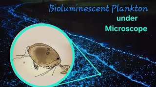 Bioluminescent plankton under microscope [upl. by Yelraf]