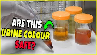 What your Urine Colour Says About Your Health [upl. by Nappie]