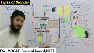 hemodialysis and peritoneal dialysis  types of dialysis [upl. by Findlay]