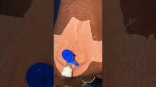 Intravenous IV cannulation procedure amp technique [upl. by Lipski]