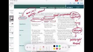 Coagulative Necrosis Vs liquefactive Necrosis Pathology 11  First Aid USMLE Step 1 in UrduHindi [upl. by Ybloc]