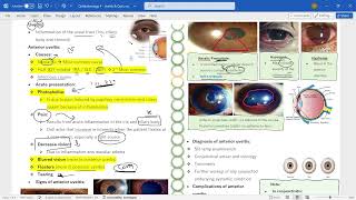 Ophthalmology 4  Uveitis amp optic neuritis [upl. by Coh]