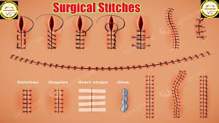 suture techniques how to do stitches suture procedures surgical suture [upl. by Peregrine576]