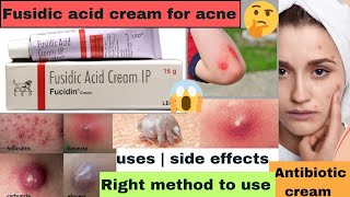 Fucidin cream Fusidic acid cream uses in hindi Antibiotic ointment fucidin cream for boils [upl. by Anitsenre810]