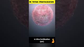 In Vitro Fertilization animation।।in vitro fertilization and embryo transfer ।।shortsivf [upl. by Rolyks113]