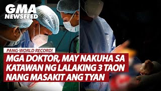 Mga doktor may nakuha sa katawan ng lalaking 3 taon nang masakit ang tiyan  GMA News Feed [upl. by Gnouh813]