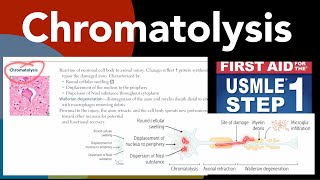 Chromatolysis Wallerian degeneration Axonal regeneration in HindiUrdu by first aid forUSMLE step1 [upl. by Sonny45]