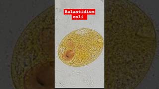 Balantidium coli en él laboratorio clínico [upl. by Sumaes]