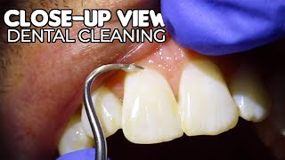 Dental Cleaning  CloseUp View ASMR [upl. by Attemaj]