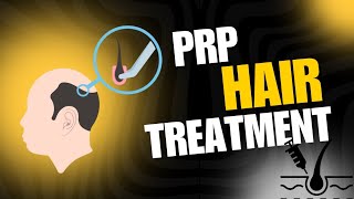 PrP Treatment In Ammar Medical Complex Muridke prp treatment [upl. by Attennyl]