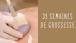 35 semaines de grossesse [upl. by Odlareg]