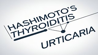 Understanding the Link Between Chronic Spontaneous Urticaria and Thyroid Health [upl. by Norina528]