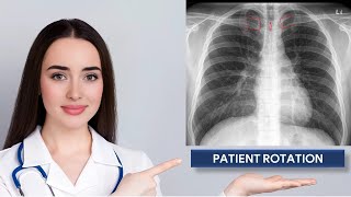 Assessment of Patient Rotation on Chest X ray [upl. by Jeremy475]