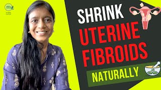 Shrink Uterine Fibroid with Ayurvedic Natural Treatment  10 Best Herbs Yoga and Diet Tips [upl. by Brunhilda]