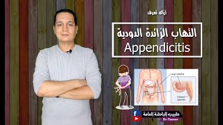 ازاى تعرف حالة التهاب الزائدة الدودية فى الطوارئ appendicitis [upl. by Neeluj]