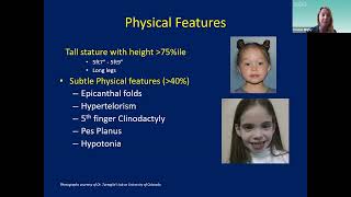 Kristen Wigby MD  Trisomy X A Review and Care Update for Families and Health Care Providers [upl. by Nileuqcaj]