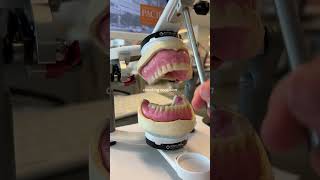 Denture making in prosthodonticsshorts prosthodontics viral trending dentistry bds [upl. by Furmark525]