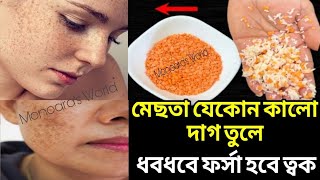 এটি ১ বার মুখের ত্বকে লাগিয়ে দেখুনকঠিন মেছতা দূরমেছতা দূর করার ঘরোয়া উপায় [upl. by Ardnaiek490]