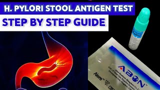 Helicobacter pylori Stool Antigen Test MEDICAL LABORATORY SCIENCE [upl. by Anna]