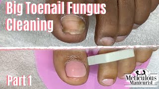 How To Pedicure Toenail Fungus Home Remedy Cleaning Part 1 [upl. by Howenstein982]