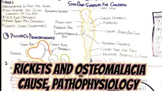 Rickets And Osteomalacia umerfarooqbiology7083 [upl. by Mathur]