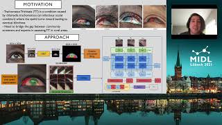 TT algorithm presentation [upl. by Uticas]