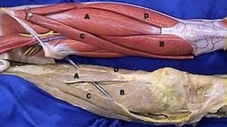 The Lower Limb  Great Saphenous Vein dissection  MGA Lab 1  LMU amp DCOM [upl. by Aynodal]