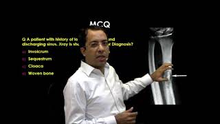 eQ Recent Exam Question Radiology  Sequestrum [upl. by Arica]