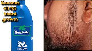 Coconut oil for beard growth  नारियल तेल से दाढ़ी उगाये केवल 1 दिन मैं [upl. by Dona]