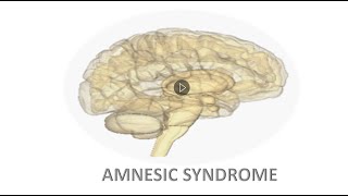 Amnesic Syndrome Presentation by Prof Dr Imran Ijaz Haider [upl. by O'Conner]