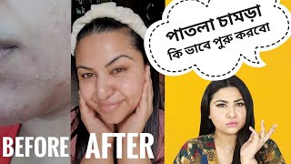 পাকিস্তানী ক্রিম মেখে যারা মুখ নষ্ট করেছো  Heal Skin Barrier from Whitening Bleaching Fair Polish [upl. by Teragram]