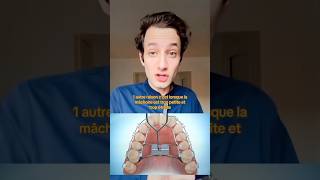 POURQUOI LE DISJONCTEUR AVANT LES BAGUES  🦷👨‍⚕️ dentiste orthodontie appareildentaire [upl. by Aseel]