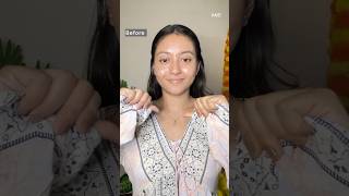 Say goodbye to Pigmentation in just 3 Steps skincare beauty shorts ytshorts [upl. by Mossman827]