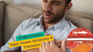 Stable Angina Causes Symptoms and Treatment [upl. by Intruoc]