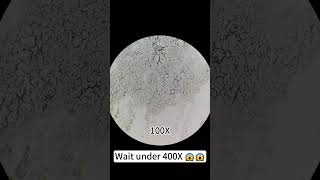 Pimples at 400X magnification are really cool underthemicroscope beefcut scienceshorts [upl. by Allayne931]