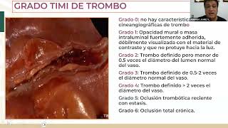 5 Nomenclatura utilizada en hemodinamia [upl. by Lorita802]