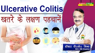 ULCERATIVE COLITIS ख़तरे के लक्षण पहचानें  ASK THE EXPERT HOW SERIOUS IS ULCERATIVE COLITIS [upl. by Jinny]