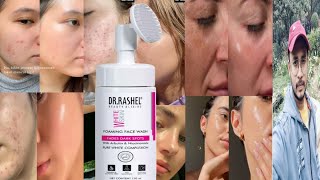 Dr Rashel White Skin Foaming Face Wash  Honest Review [upl. by Letniuq]