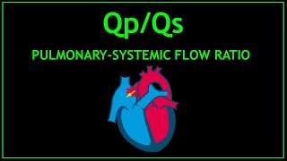 QpQs Ratio Echocardiography [upl. by Fredra]