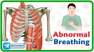 Accessory muscle Breathing Agonal Breathing Apneustic breathing Asterixis and Biots Breathing [upl. by Cyndy]