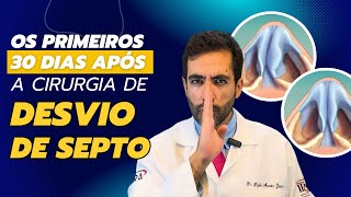 30 dias após cirurgia do septo nasal O que você PRECISA saber [upl. by Whipple]