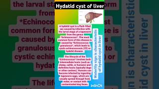 HYDATID CYST OF LIVER aiapgetpreparation neetpgnotes medicallectures youtubeshorts [upl. by Aizitel]